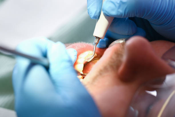 Best After-Hours Emergency Dentist in Dorneyville, PA