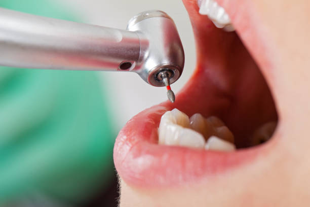 Best Weekend Emergency Dentist in Dorneyville, PA